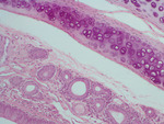 MISSING THUMBNAIL